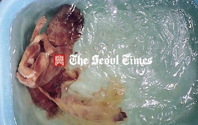 تقليعة مُريعة.. في الصين يأكلون لحم الاجنة لتقوية ادائهم النوعي!! صورة رقم 1