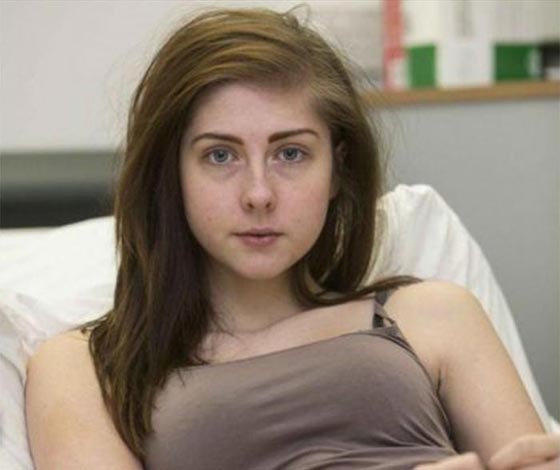 قصة البطن المنتفخ لمراهقة في ريعان الشباب صورة رقم 1