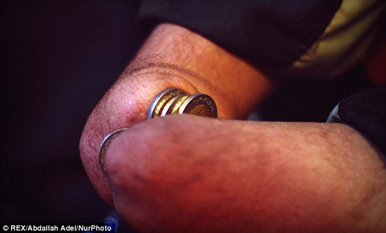  بالصور: علي عفيفي.. اول سارق في العالم يعاقب نفسه بقعه ليديه  صورة رقم 3