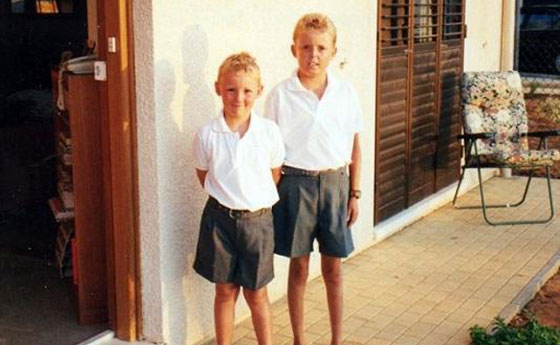 شاهدوا البريطاني الذي يرفض جسده الاحتفاظ بالدهون صورة رقم 15