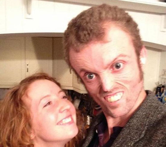 شاهدوا البريطاني الذي يرفض جسده الاحتفاظ بالدهون صورة رقم 12