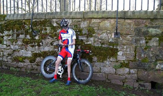 شاهدوا البريطاني الذي يرفض جسده الاحتفاظ بالدهون صورة رقم 6