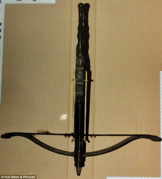 بأعجوبة نجا من سهم قاتل اخترق راسه صورة رقم 3