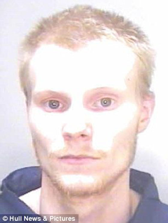 بأعجوبة نجا من سهم قاتل اخترق راسه صورة رقم 5