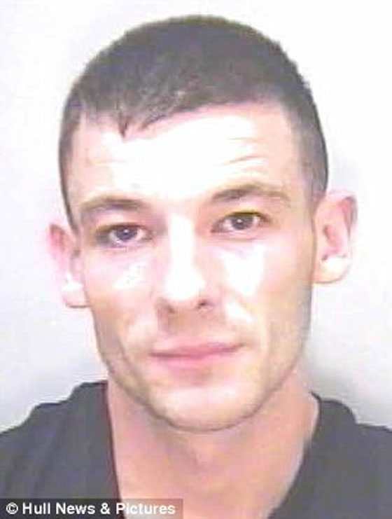 بأعجوبة نجا من سهم قاتل اخترق راسه صورة رقم 6