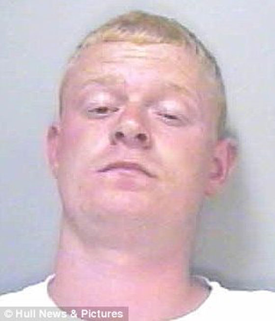 بأعجوبة نجا من سهم قاتل اخترق راسه صورة رقم 4