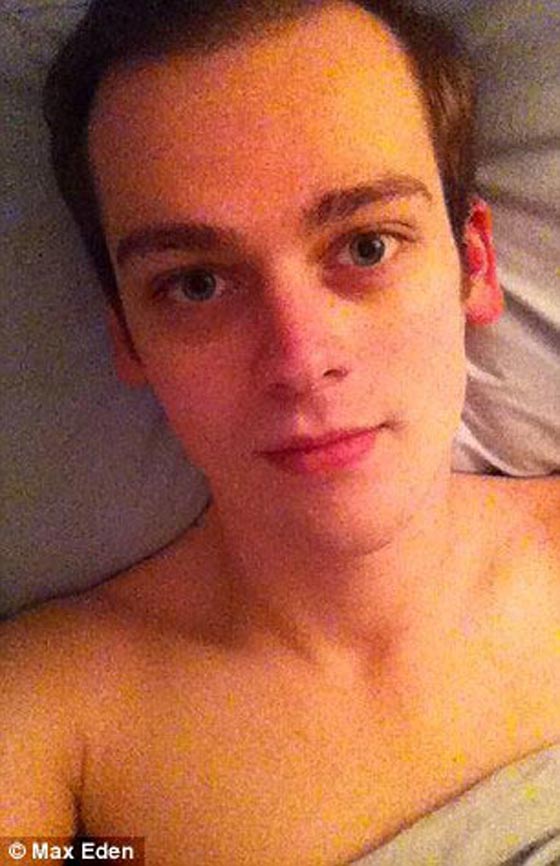 مراهق سمين جدا يخسر 60 كغم ويصبح عارض ازياء ناجح صورة رقم 9 مراهق سمين جدا يخسر 60 كغم ويصبح عارض ازياء ناجح صورة رقم 9