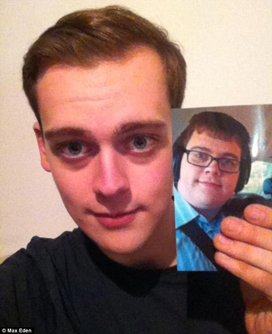 مراهق سمين جدا يخسر 60 كغم ويصبح عارض ازياء ناجح صورة رقم 7 مراهق سمين جدا يخسر 60 كغم ويصبح عارض ازياء ناجح صورة رقم 7