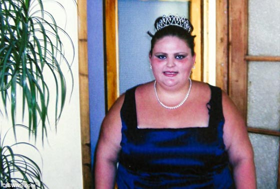 امي اخبرتني اني ساموت قبلها ان لم ينزل وزني ففقدت 65 كغم صورة رقم 3