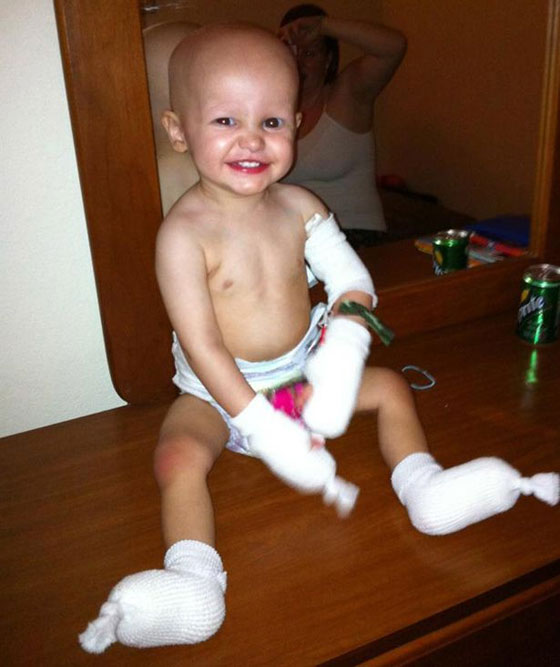 الطفل الذي هزم السرطان واثبت خطأ الاطباء الذين ارادوا بتر اطرافه! صورة رقم 2 الطفل الذي هزم السرطان واثبت خطأ الاطباء الذين ارادوا بتر اطرافه! صورة رقم 2