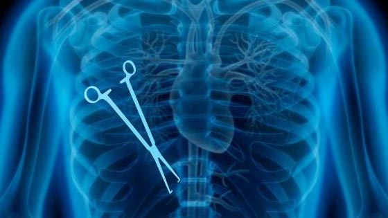 الاخطاء الطبية قتلت 19 الف الماني العام الماضي صورة رقم 1