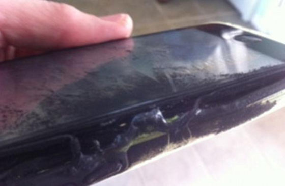 اصابة طالبة بحروق بعد انفجار ايفونها في جيب بنطلونها صورة رقم 1