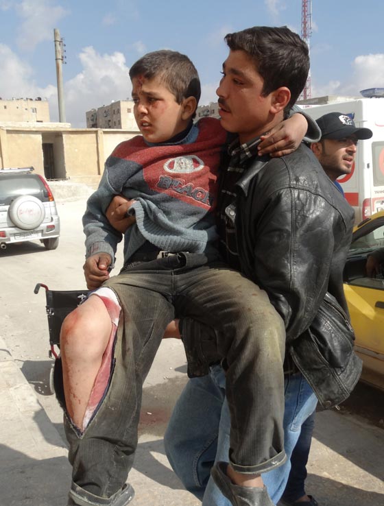 الازمة السورية تغضب هوكينغ: التكنولوجيا تقتل اطفال سوريا ولا تسعفهم! صورة رقم 5