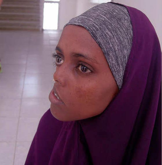 بالصور.. غدا ستعود البسمة لوجه ايان الذي شوهته شظايا الحرب  صورة رقم 1