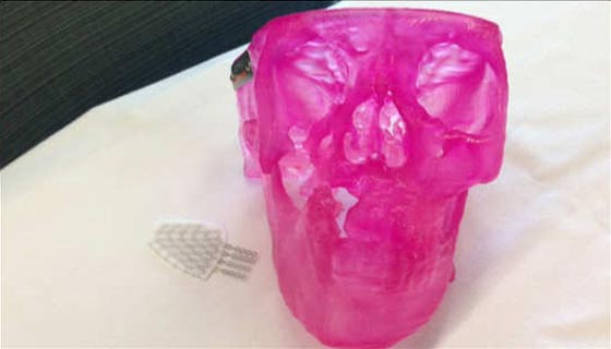 بالصور.. غدا ستعود البسمة لوجه ايان الذي شوهته شظايا الحرب  صورة رقم 4