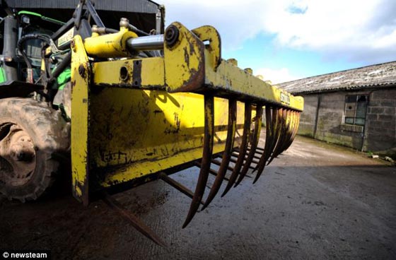 بالصور.. اخترقت جسمه شفرة حراثة زراعية.. ونجا باعجوبة!! صورة رقم 7