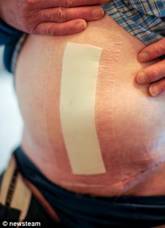 بالصور.. اخترقت جسمه شفرة حراثة زراعية.. ونجا باعجوبة!! صورة رقم 3