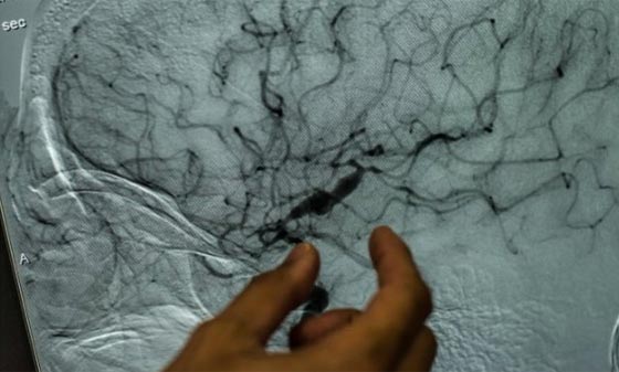 بعد ان عجز الطب عن تفسير معجزاته.. تطويب البابا بولس الثاني قديسا صورة رقم 3