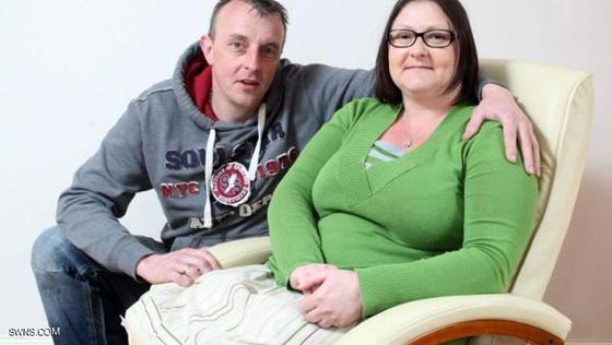 السجائر تسببت في بتر ساقيها.. فسارعت للتحذير منها بصورتها صورة رقم 1