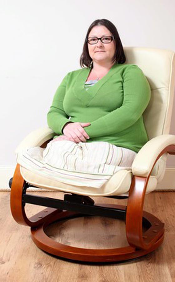 السجائر تسببت في بتر ساقيها.. فسارعت للتحذير منها بصورتها صورة رقم 6