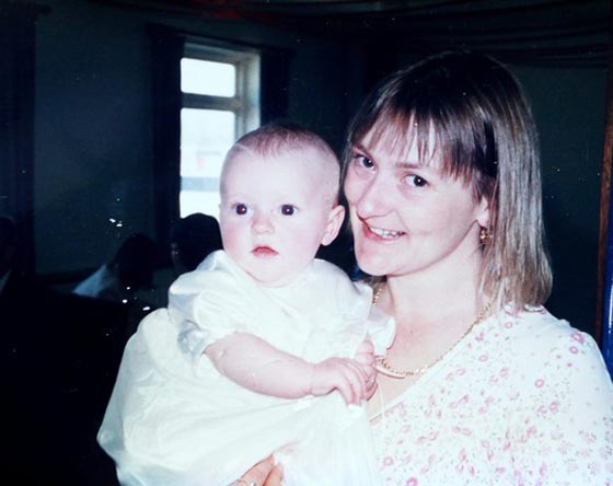 السجائر تسببت في بتر ساقيها.. فسارعت للتحذير منها بصورتها صورة رقم 7