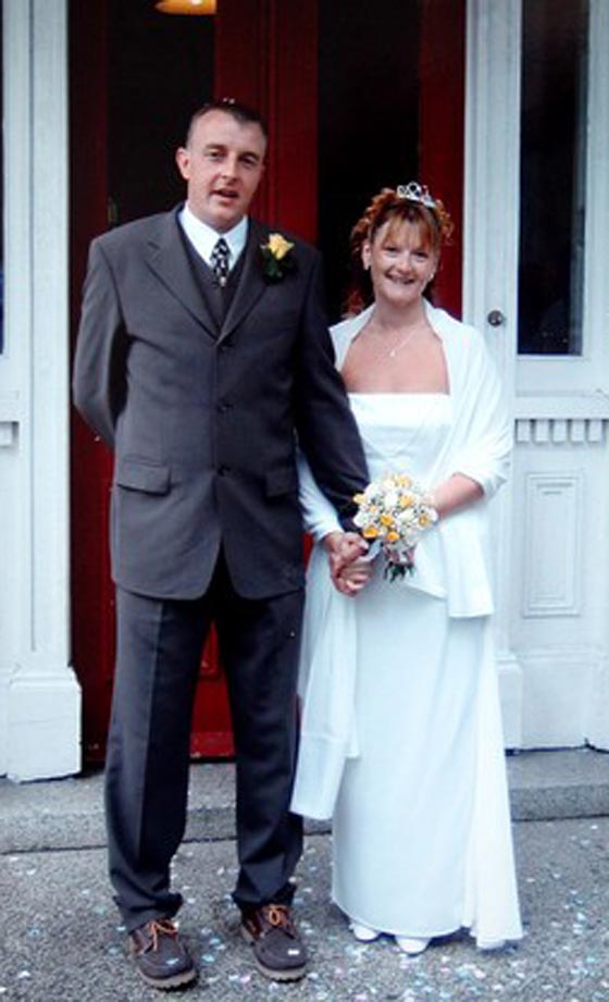 السجائر تسببت في بتر ساقيها.. فسارعت للتحذير منها بصورتها صورة رقم 8