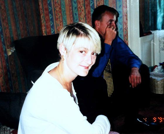 السجائر تسببت في بتر ساقيها.. فسارعت للتحذير منها بصورتها صورة رقم 9