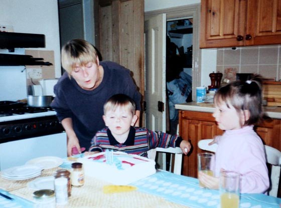 السجائر تسببت في بتر ساقيها.. فسارعت للتحذير منها بصورتها صورة رقم 10