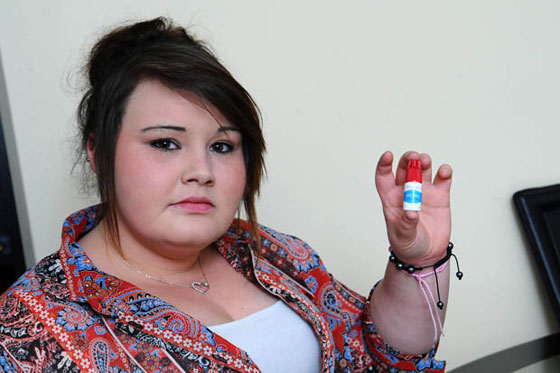 تحذير: صور مروعة لاصبع مراهقة التهب بسبب الصاق اظافر مستعارة  صورة رقم 6