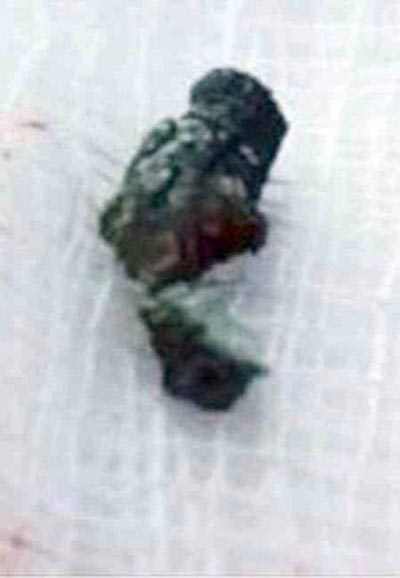 الكويت: خادمات وضعن طلاسم السحر الاسود في فم وأذنَي طفل صورة رقم 1