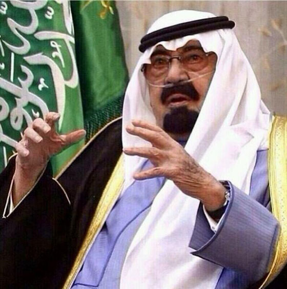 العاهل السعودي يستخدم انبوب تنفس ووكالة الانباء تخفيه! صورة رقم 1