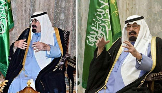 العاهل السعودي يستخدم انبوب تنفس ووكالة الانباء تخفيه! صورة رقم 2