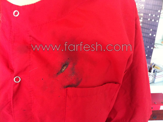 انفجاز جهاز جالكسي S3 بيد فتاة يتسبب باحتراق قميصها صورة رقم 6