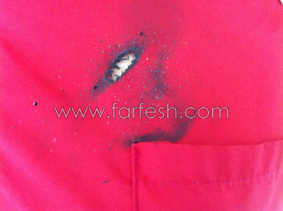 انفجاز جهاز جالكسي S3 بيد فتاة يتسبب باحتراق قميصها صورة رقم 7