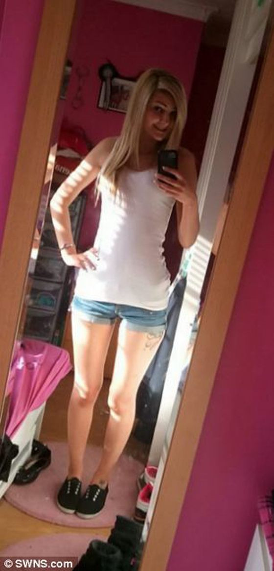 اصحاب النفوس الخيرة يتبرعون بسخاء لتكبير ثديي بريطانية صورة رقم 6