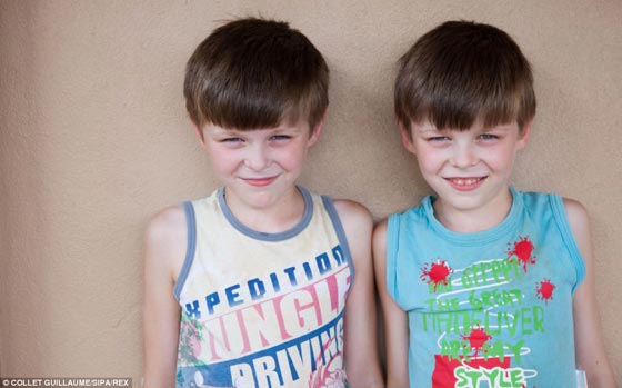 مدينة التوائم البرازيلية تتكتم على اسرارها العجيبة صورة رقم 11