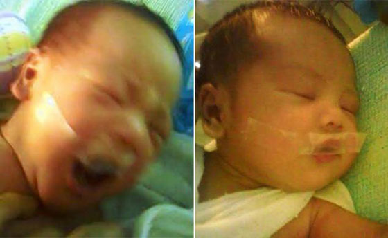 لماذا وضعت الممرضة الشريط اللاصق على فم المولود الجديد؟ صورة رقم 1