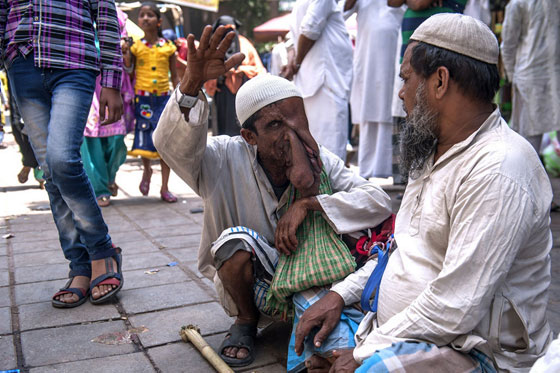  صور قاسية لرجل مشوه الوجه يرفض عملية جراحية مجانية ليستمر في التسول  صورة رقم 2