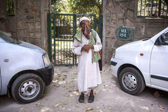  صور قاسية لرجل مشوه الوجه يرفض عملية جراحية مجانية ليستمر في التسول  صورة رقم 6