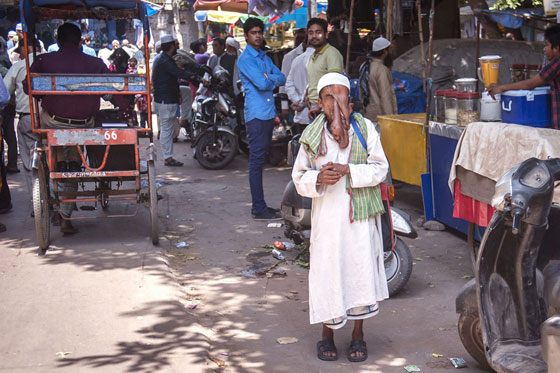  صور قاسية لرجل مشوه الوجه يرفض عملية جراحية مجانية ليستمر في التسول  صورة رقم 7