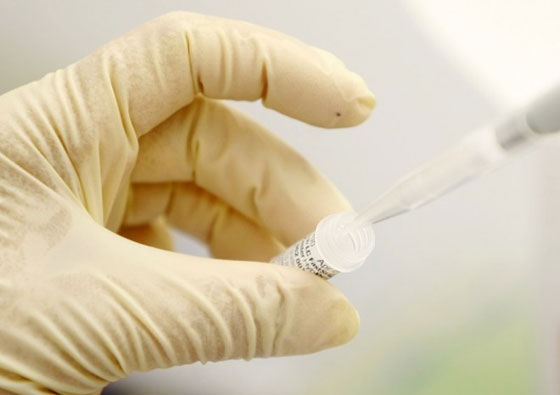 فضيحة.. سرقة ادمغة وقلوب اطفال متوفين لاغراض البحث في النرويج صورة رقم 2