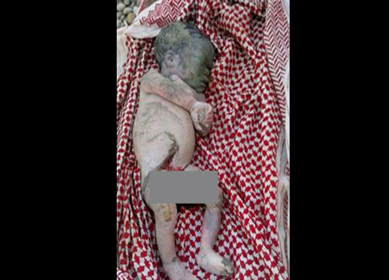 صورة.. العثور على جثة مولودة ملقاة على شاطئ في حضرموت  صورة رقم 1