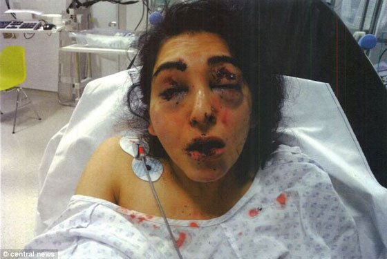 فقء العين.. انتقام مريع لهندي شك في سلوك زوجة ابنه!! صورة رقم 1