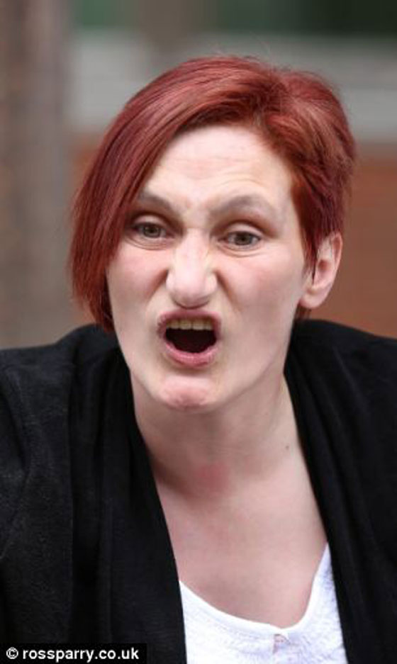 وضعت طفلها في الماء السخن وتناولت المخدرات فوجدته مسلوقا صورة رقم 4