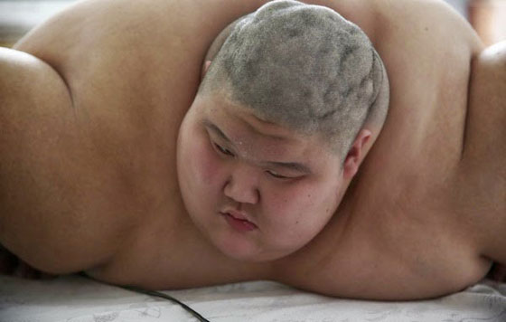 بالصور.. ربع طن تثقل كاهل شاب صيني وتعجِّز اسرته صورة رقم 3