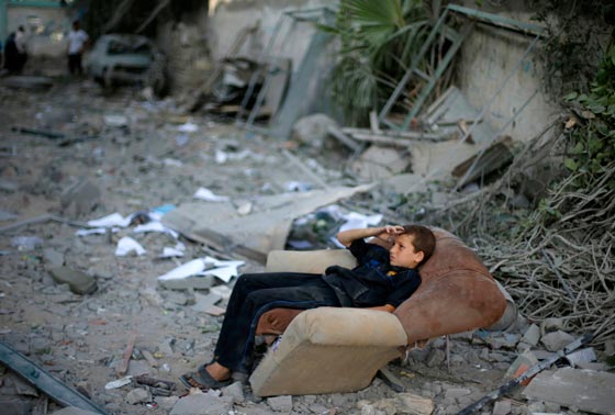 بالصور.. الطفولة تدفع دمعها ودمها في حرب لا شبق لها فيها ولا عبق صورة رقم 5