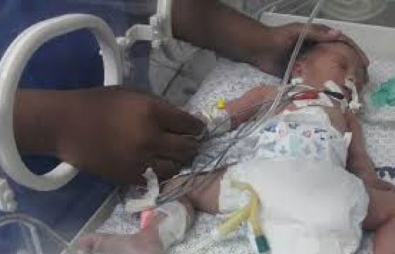 خطأ طبي بمستشفى يتسبب في بتر ذراع رضيعة في مصر صورة رقم 1