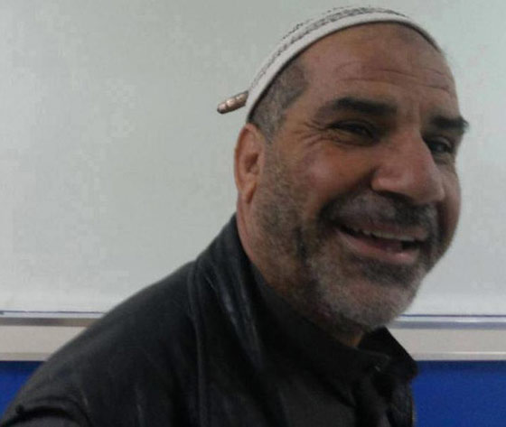 بالصور.. الرجل العراقي الذي عجزت الرصاصة عن اختراق رأسه صورة رقم 2