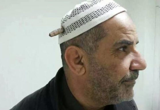 بالصور.. الرجل العراقي الذي عجزت الرصاصة عن اختراق رأسه صورة رقم 1