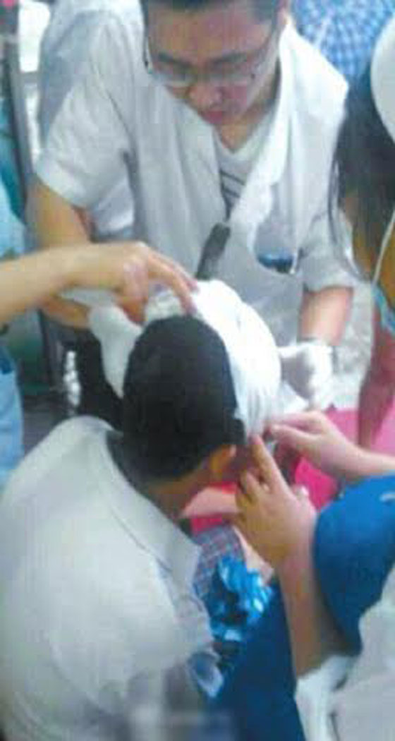 بالصور.. سكين يسقط من الطابق الثامن لينغرس في رأس رجل صيني صورة رقم 3